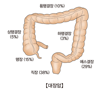 "암 종류별 초기 증상" 암 발생 시 나타나는 증상들