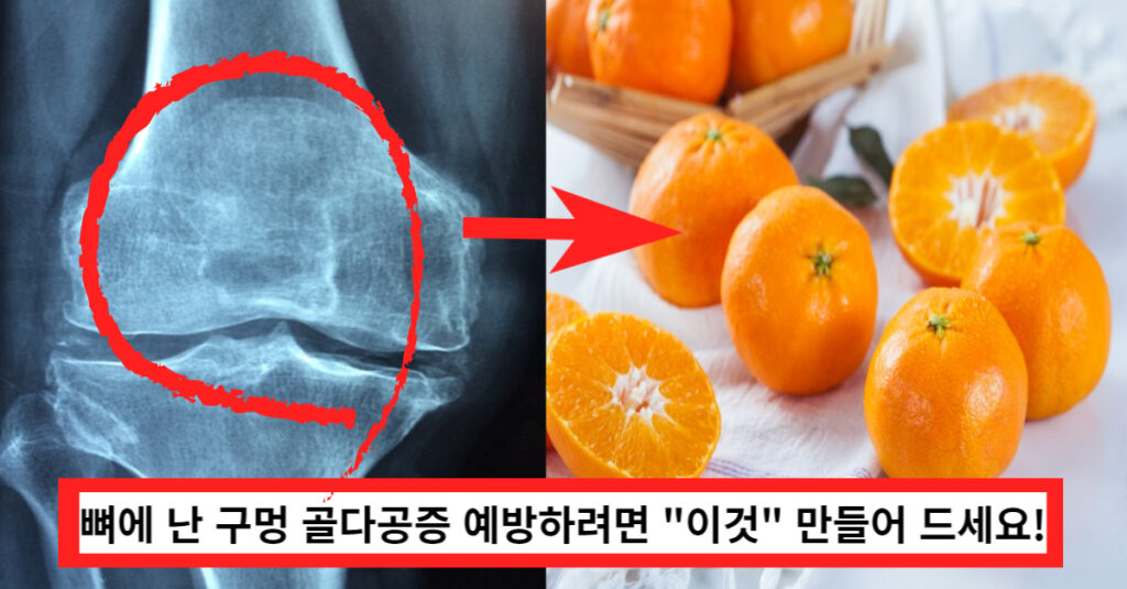 골다공증 예방하려면 귤로 "이것" 만들어 드세요!